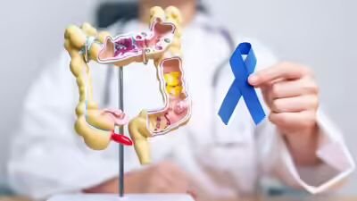 Oncologist Highlights Five Practical, Evidence-Based Ways Indians Can Lower Colorectal Cancer Risk