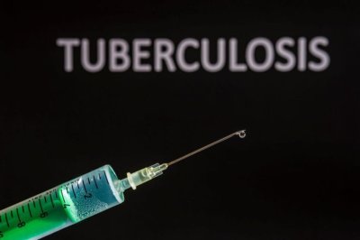 Nanded University Bags Patent for Advanced TB Drug Delivery System