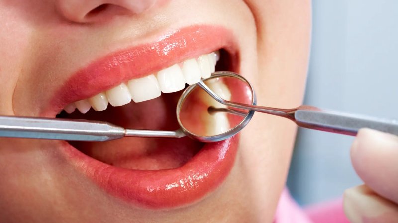 Dentist With 40 Years of Experience Reveals Foods That Look Harmful but Actually Protect Your Teeth