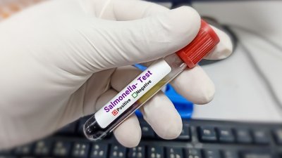 टाइफाइड बना गंभीर स्वास्थ्य संकट: 2023 में 49 लाख से ज्यादा मामले, 7,850 मौतें; दवाएं हो रहीं बेअसर