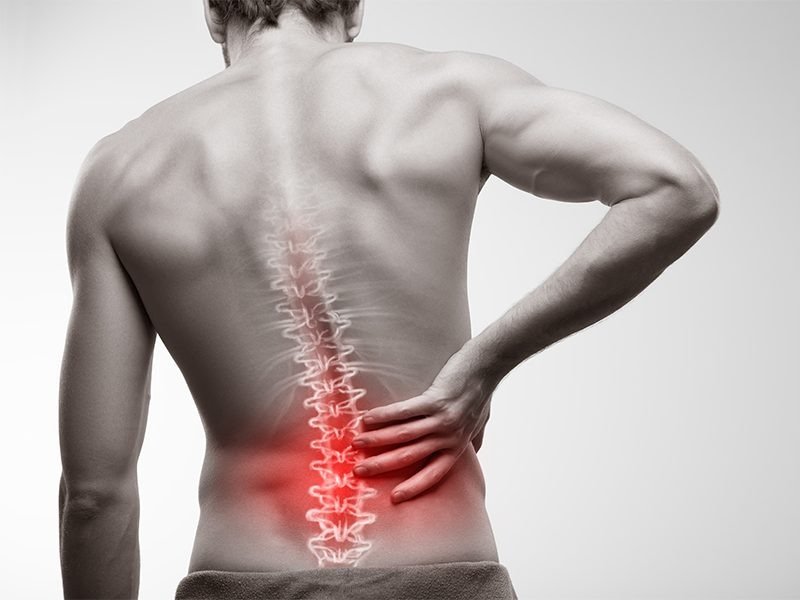 Poor Posture and Overtraining May Lead to Chronic Back Pain Even in Fit Individuals, Warns Spine Surgeon