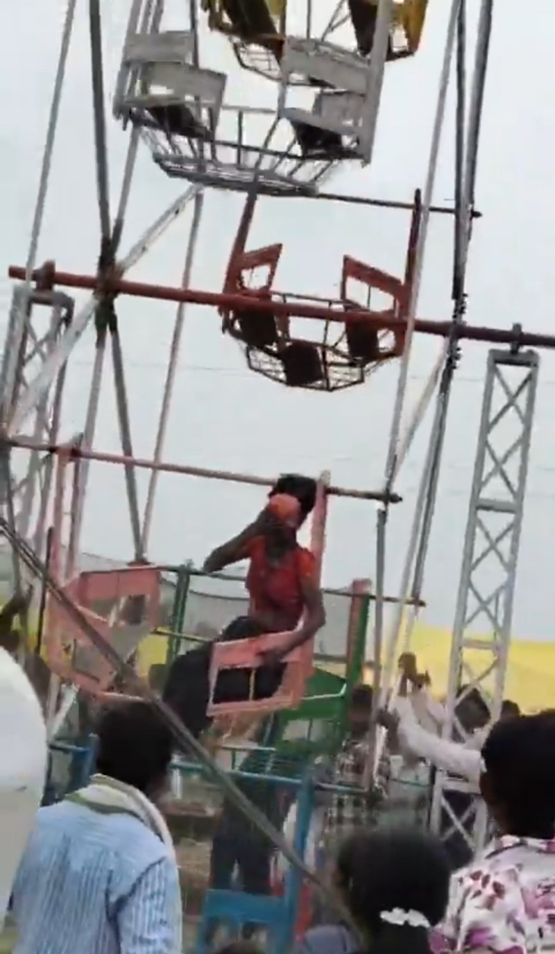 Ferris Wheel Accident Tears Woman’s Scalp
